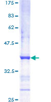 12.5% SDS-PAGE Stained with Coomassie Blue